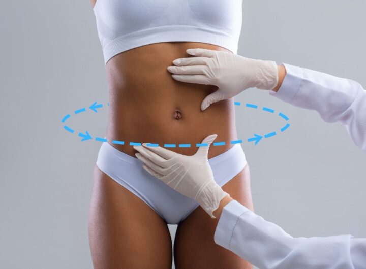 360 Liposuction