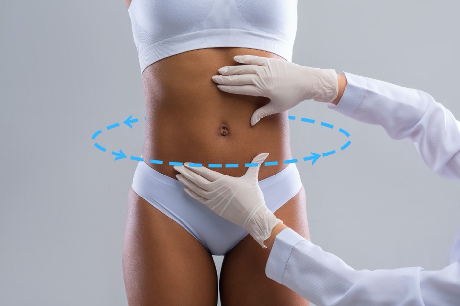 360 Liposuction