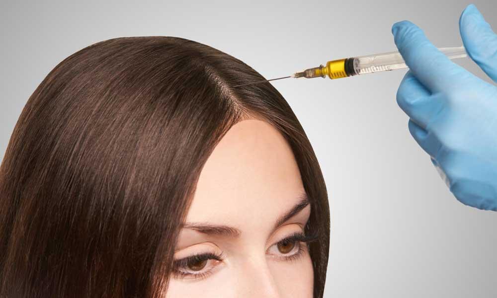 Women's Hair Loss Treatment in Singapore