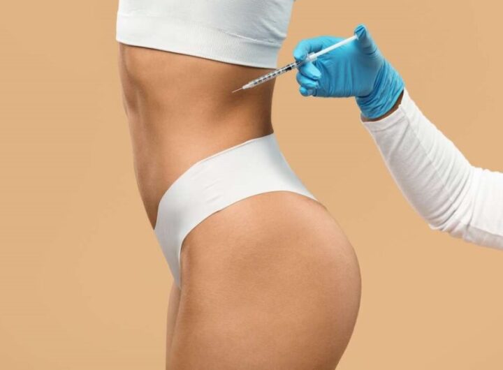 CoolSculpting Procedure