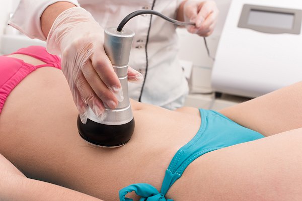 CoolSculpting Procedure